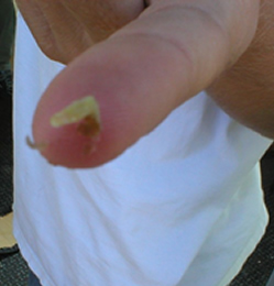ABC Booger