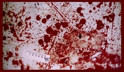 A Bloody Mess