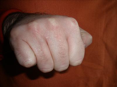 Bare-knuckle Bump