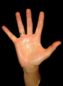 Sweaty Palm Handshake