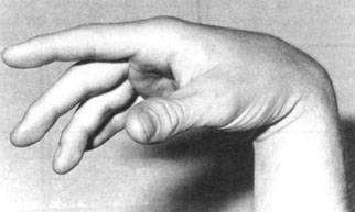 Limp Wrist Handshake