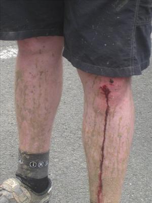 Leaky Knee