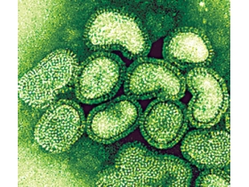 influenza suina, tipo A H1N1