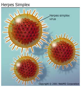 Herpes