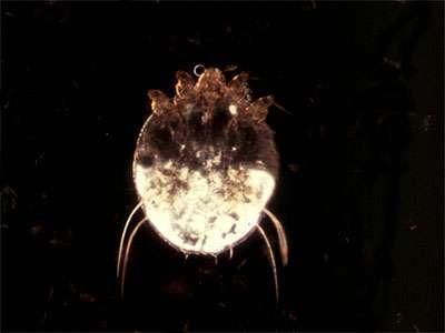 Scabies