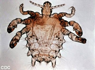 Crabs