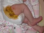baby's shit