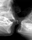 A kiss