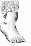 pied droit