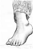 pied gauche