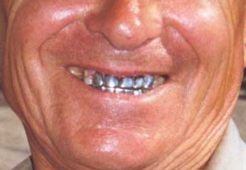 sorriso