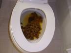 Poo