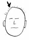 Head