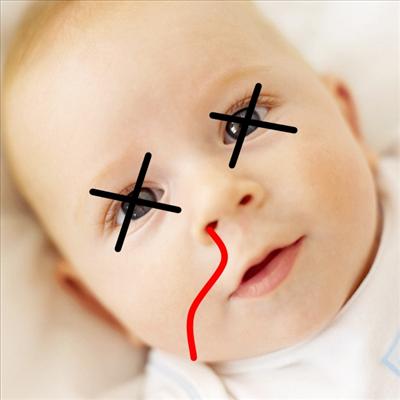 Dead Baby