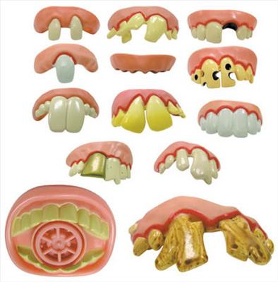 HOT5B-dentures-by-dwayne-funny teeth bulk vending