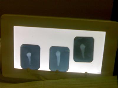 x-ray