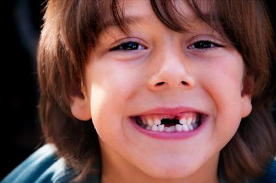 Funny Teeth