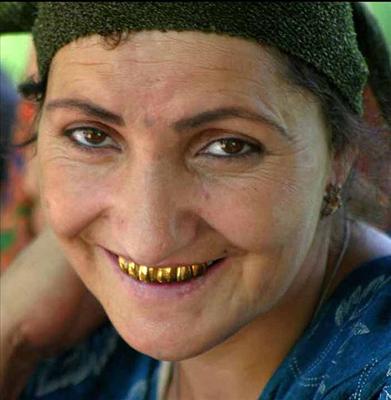Zlati nasmeh