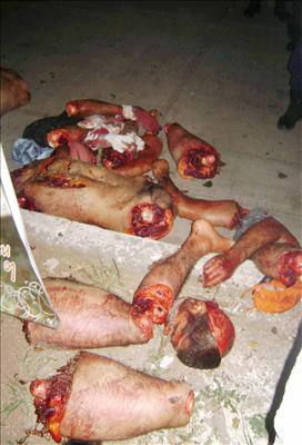 Dismembered Body 