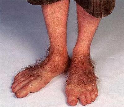 Feet