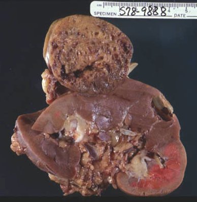 Lipids