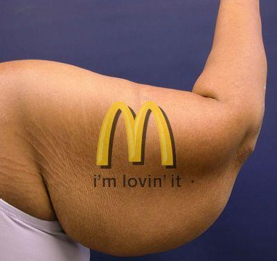 Fette Arm!
