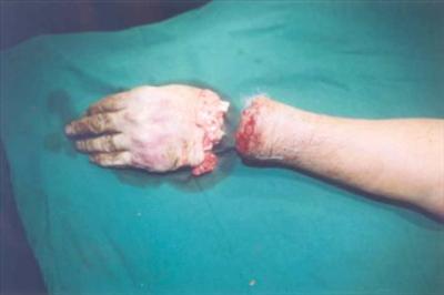 dead hand