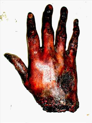fried hand