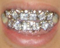 Grill