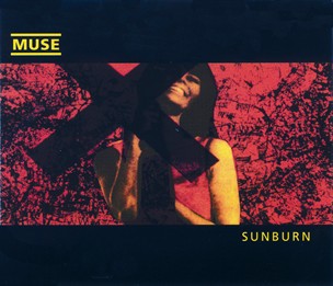 Sunburn