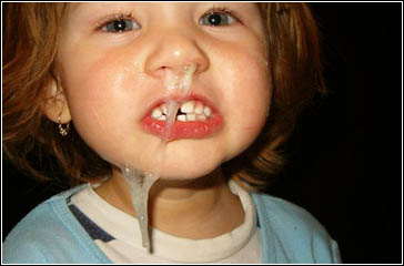 Snot