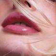 Kiss2