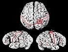 Einstien Brains