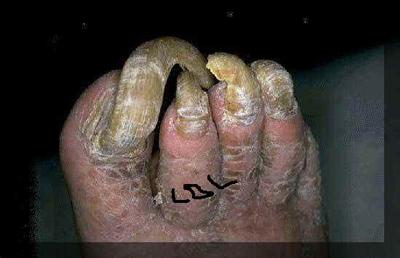 A foot..