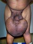 ARXIDIA