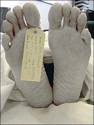 un cadaver