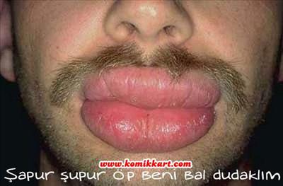 öpücük