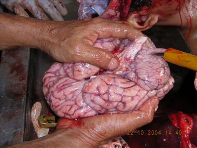 cereberum