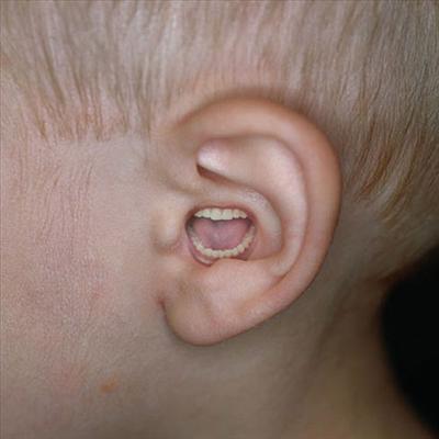 ear