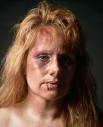 abused adult