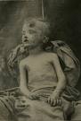 abused child 4