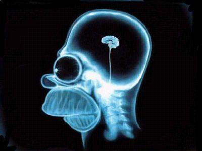 Estupido 