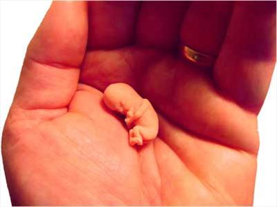 2 month fetus