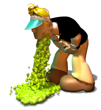 VOMI