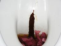 antiarc