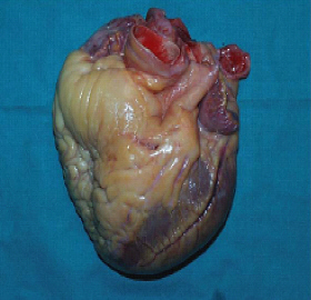 un coeur