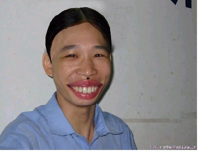 xấu trai