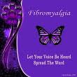 FM Butterfly