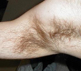 armpit hair