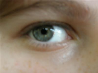 gilad sofer eye